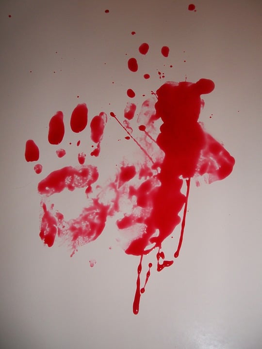 How to Properly Clean up Blood How to Properly Clean up Blood